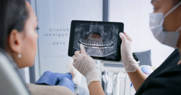 Licensed Tooth Extraction service in Rohnert Park, CA - Smile Center Dentistry